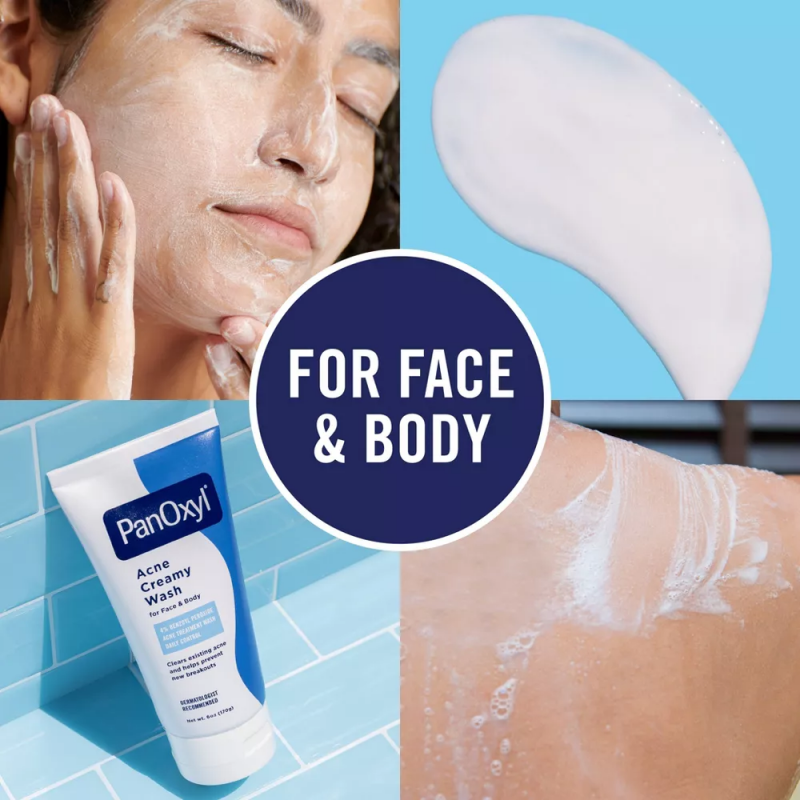 غسول كريمي لحب الشباب بنزويل بيروكسيد 4٪ من بانوكسيل حجم 170 غم -PanOxyl Acne Creamy Wash Daily Control Face & Body 4% Benzoyl Peroxide All Sk By PanOxyl 170g