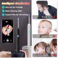 مزيل شمع الأذن اللاسلكي منظار الأذن مع إضاءة LED ذات كاميرا صغيرة مع عدة رؤوس -يعمل بالشحن ويمكن تنظيفه بالماء 