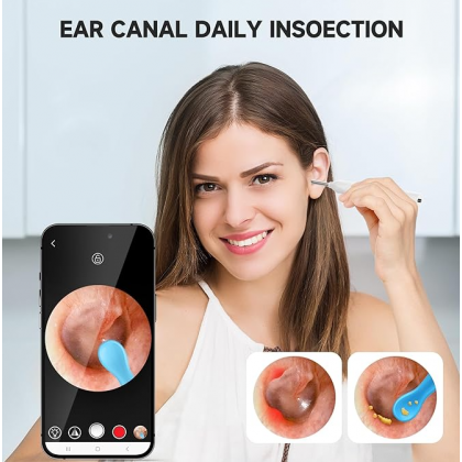 منظار تنظيف الاذن